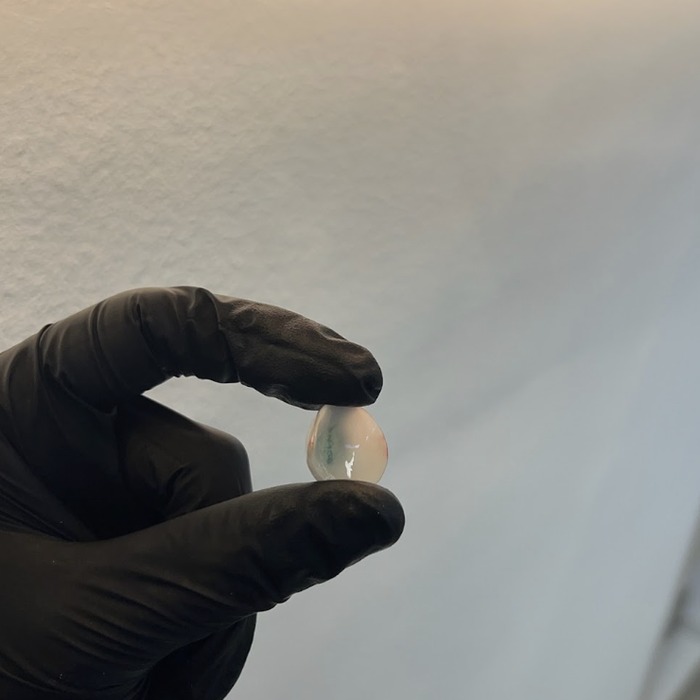 Prótesis tipo cascarilla — capa externa transparente