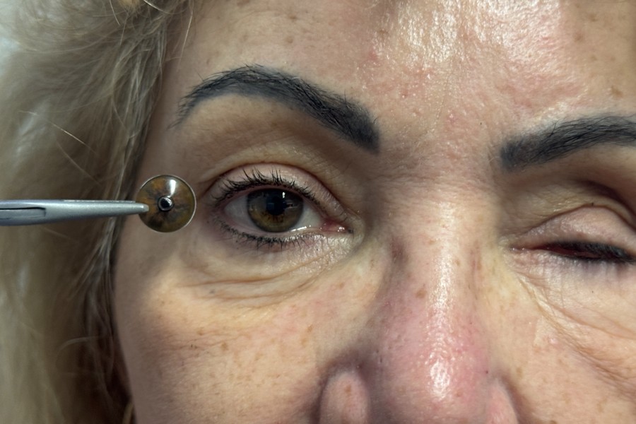 Antes — ajuste del color del iris junto al ojo natural