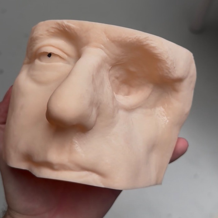 Antes — epítesis facial en proceso de fabricación