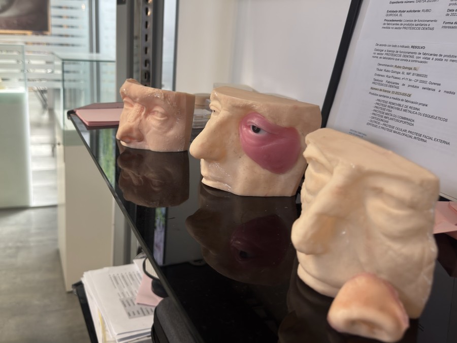 Taller de epítesis faciales en Rubio y Quiroga Ocularistas Ourense — modelos y proceso artesanal