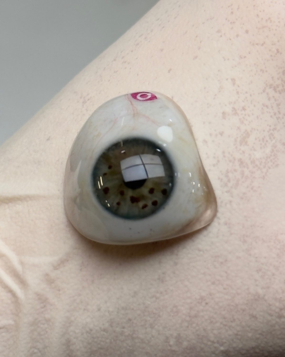 Prótesis ocular total fabricada artesanalmente en Rubio y Quiroga Ocularistas, Ourense